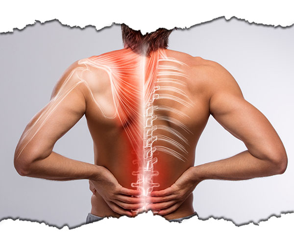 terapia coloanei vertebrale
