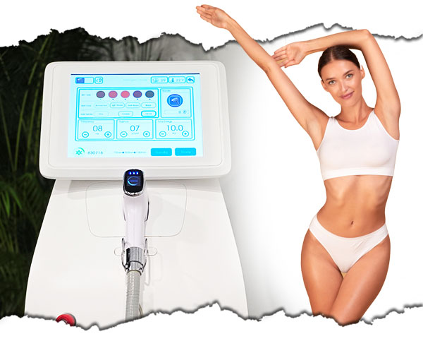epilare cu laser