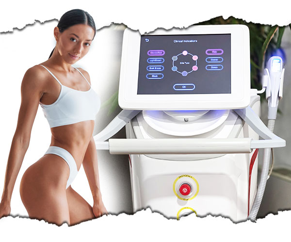 epilare cu laser