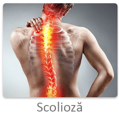 durere ascuțită la nivelul coloanei vertebrale sacrale)