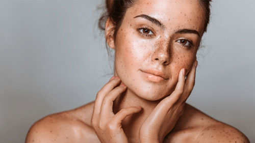 Tratament microneedling pentru estomparea petelor pigmentare și a cicatricilor post-acneice