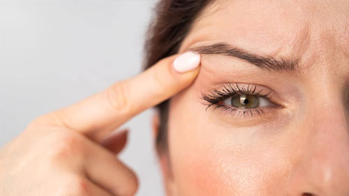 Blefaroplastie cu Plasma Pen pentru ridicarea pleoapelor căzute fără cicatrici la SenzoFit Iași