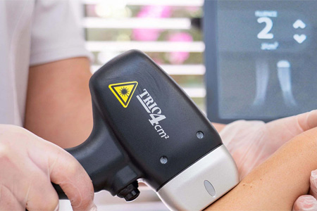 Tehnologie Triple-Wavelength Soprano