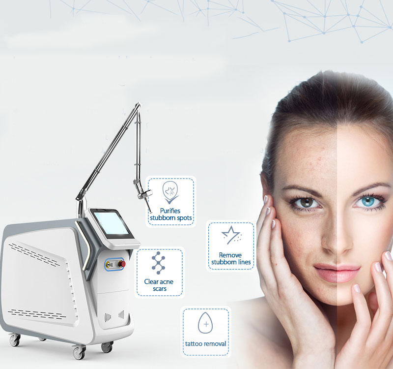 Tratament Carbon Peel - Prezentare generală