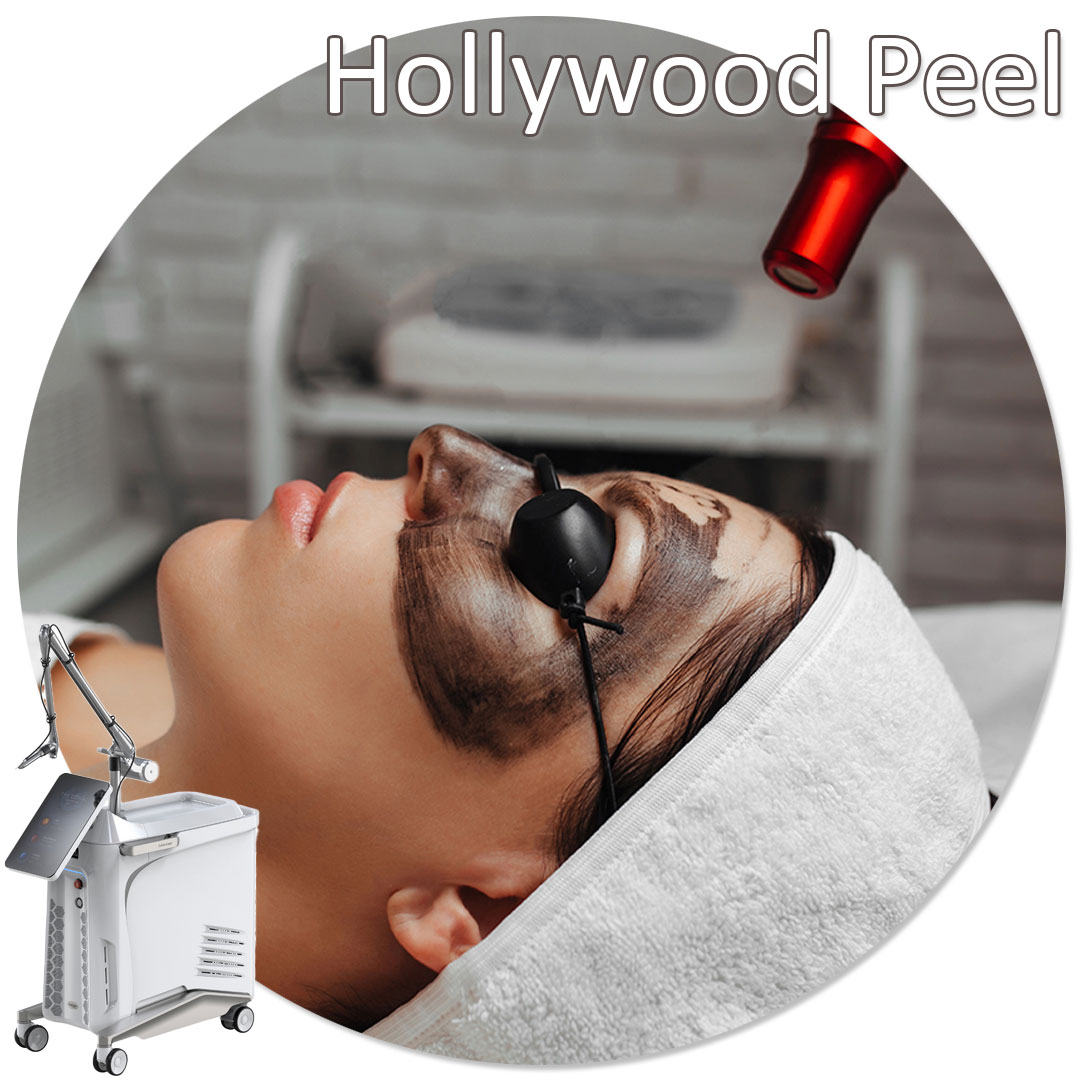 Aplicare mască carbon