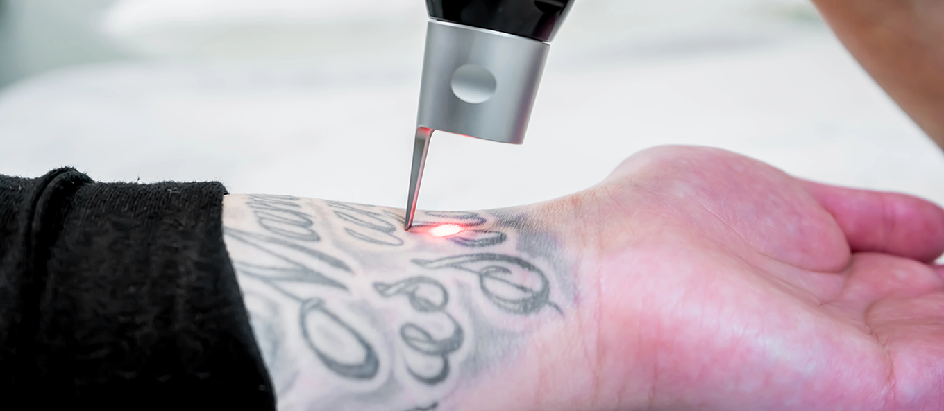 Aparat PicoLaser PicoSure in timpul tratamentului